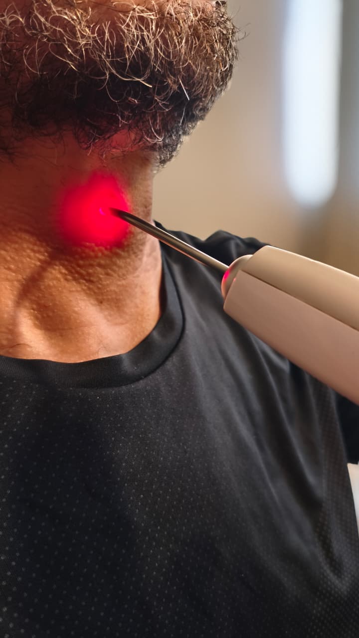 Terapia por fotobiomodulação (laser)